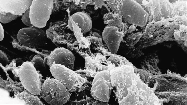Imagen de microscopio de la Yersinia pestis bacteria, causante de la peste negra o peste bubónica. (AP)