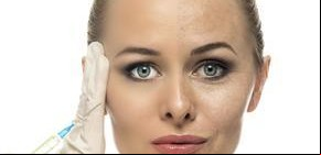 Botox vs. rellenos: ¿cuál es la mejor opción para tus arrugas?