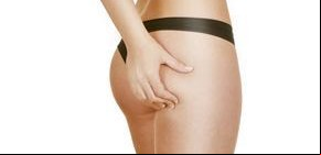11 medidas para prevenir la celulitis