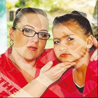 Inyecta botox a su hija de 8 años "por su bien": quiere que sea modelo y estrella de cine