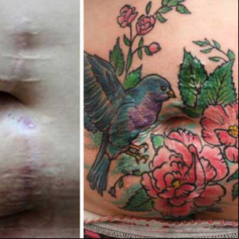 Tatuajes para cubrir las cicatrices de la violencia de género