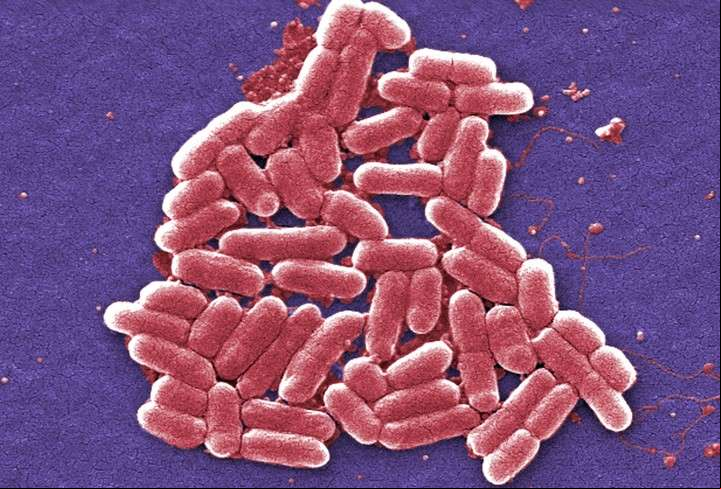 Bacterias, cada vez más resistentes a los antibióticos. (AP)