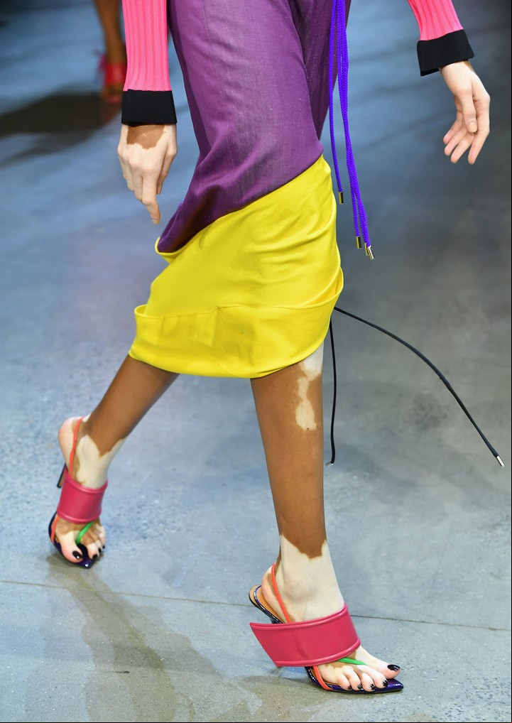 Las manchas de Harlow. La modelo, desfilando en Nueva York (AFP)