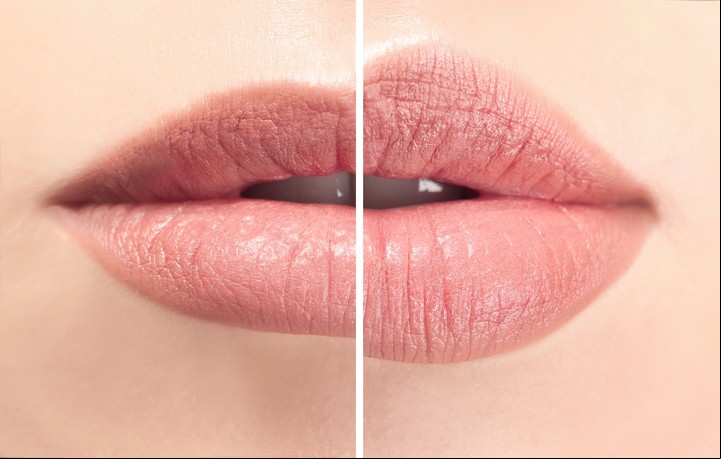 En invierno, los labios suelen resecarse y agrietarse.