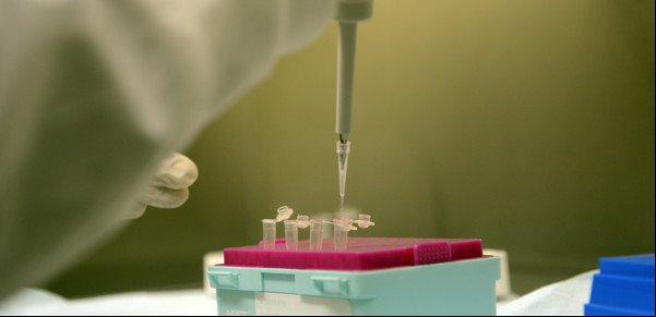 Streptococcus pyogenes: diez preguntas clave para entender la enfermedad invasiva y a quiénes afecta