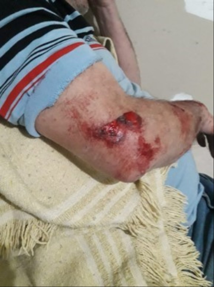 El jubilado Jorge Ríos (70) fue golpeado por los ladrones y quedó detenido por matar a uno de ellos, en Quilmes.
