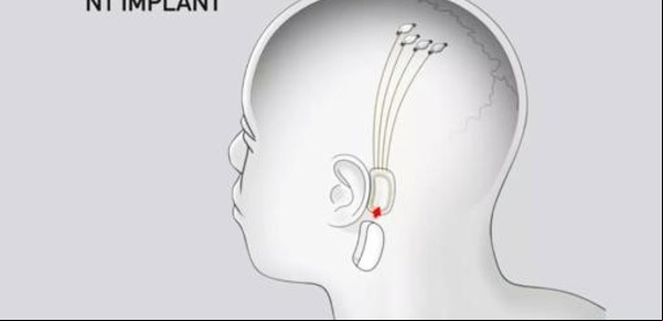 Escribe Facundo Manes: ¿se puede conectar el cerebro a una computadora?
