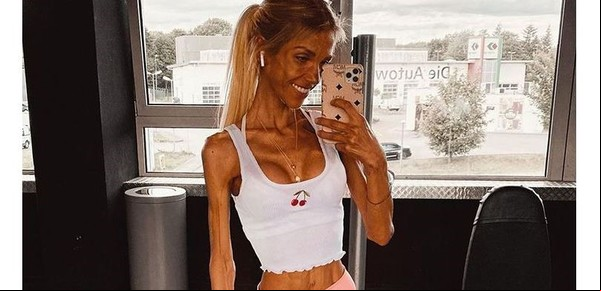 Anorexia: cuando la comida se transforma en un enemigo