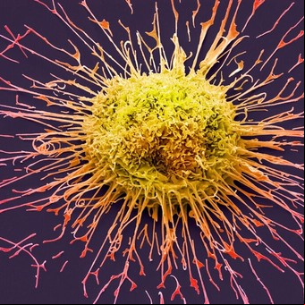 La sorprendente creencia de los argentinos sobre la cura del cáncer y por qué aún no se la conoce