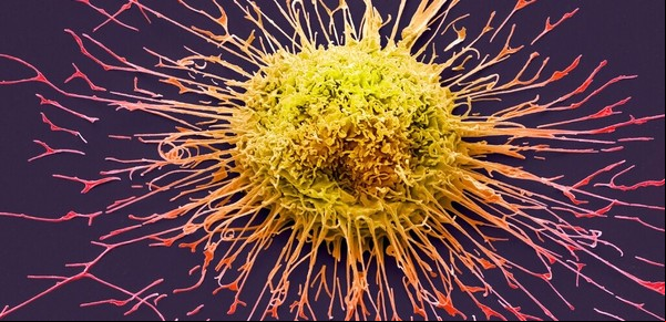 La sorprendente creencia de los argentinos sobre la cura del cáncer y por qué aún no se la conoce