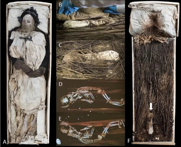 El cadáver del obispo con el feto (Krzewinska y col., J. Archaeol. Sci. Rep., 2021).