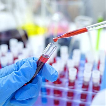 "El paciente de Ginebra": superó el VIH tras un trasplante de médula ósea y abre una nueva esperanza