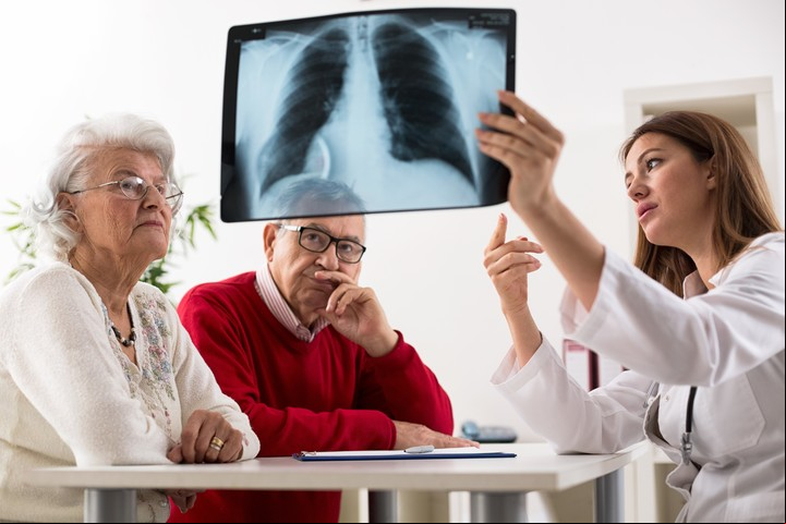 El cáncer de pulmón es la primera causa de muerte oncológica el mundo. Foto Shutterstock.