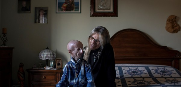 Vivir con gusto a pesar de una enfermedad rara y mortal