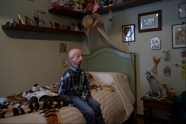 Sammy Basso, enfermo de progeria, en su habitación de Bassano del Grappa (Italia),. Foto Nadia Shira Cohen/The New York Times.