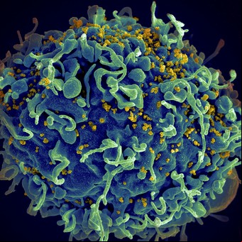 Revelan que creció tras la pandemia el riesgo de tener VIH sin saberlo: qué hacer