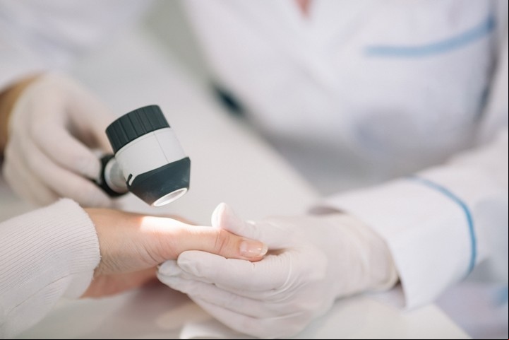Suele estar subdiagnosticada, por lo que ante signos de manchas en la piel es conveniente consultar. Foto Shutterstock.