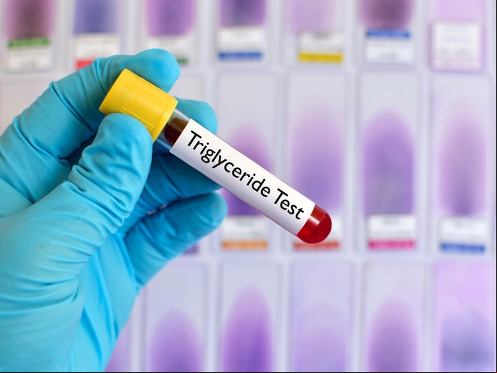 También resulta buena para los triglicéridos. Foto Shutterstock.