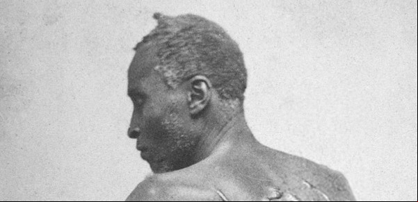 La historia de "Peter azotado", el esclavo que escapó y conmovió al mundo con su enorme cicatriz queloide
