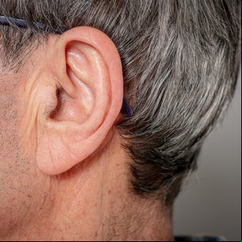 Por qué a los hombres les salen pelos en lugares raros con la edad y cómo eliminarlos