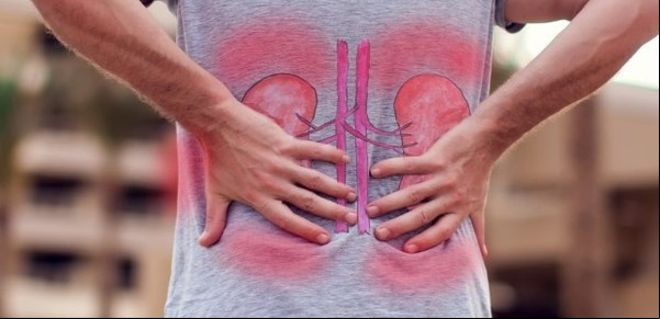 El alimento que recomiendan evitar para prevenir la aparición de cálculos en los riñones