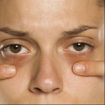 Ojeras: 5 ingredientes caseros que ayudan a eliminarlas