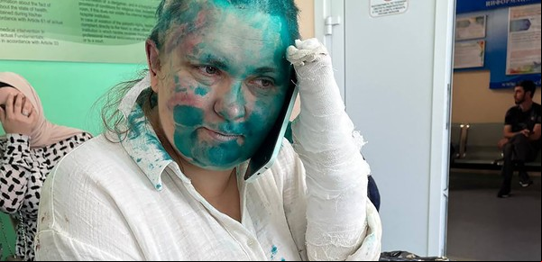 Enmascarados atacaron a una destacada periodista rusa en Chechenia y su estado es "complicado": sufrió lesiones cerebrales y le rompieron dedos de las manos