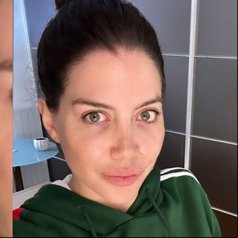 Wanda Nara aseguró que nunca se puso bótox y contó los secretos para tener "una piel divina"