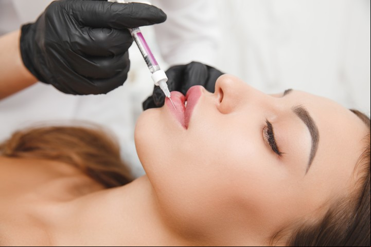 Acido hialurónico. Las inyecciones sirven para rellenar arrugas y zonas de la cara, como los labios. Foto: Clarín.