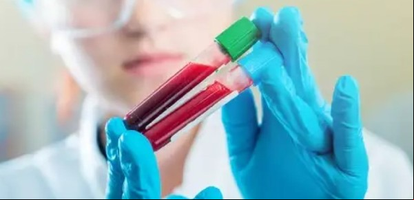 Cuáles son las ventajas y problemas poco conocidos de tener tipo de sangre 0 positivo y negativo