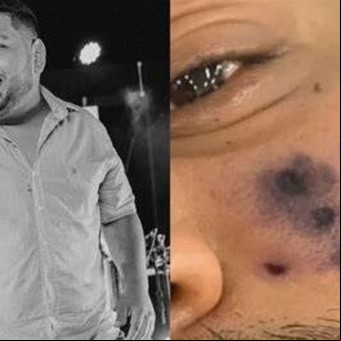 Un famoso cantante murió tras ser mordido por una araña venenosa