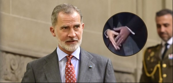 El misterio de la mano izquierda del rey Felipe VI: por qué estuvo violeta durante meses 