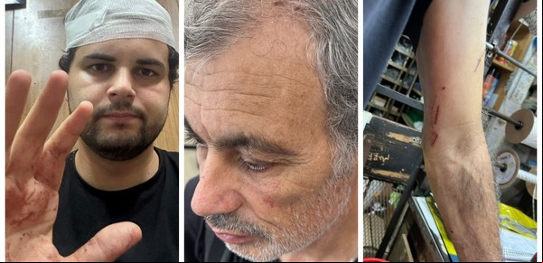 Una familia vivió una pesadilla en Beccar: golpes y mordidas al grito de "dónde está la plata"