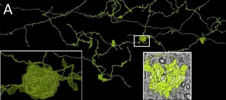 Uno de los misteriosos verticilos axonales (Shapson-Coe et al., Science , 2024).