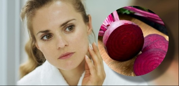 Cómo usar la remolacha para quitar las manchas de la cara