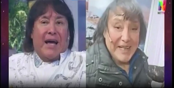 En Net TV mostraron los cambios faciales de Ricky Maravilla. Captura TV