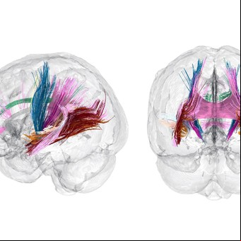 Surgen nuevas claves para determinar si el embarazo cambia el cerebro