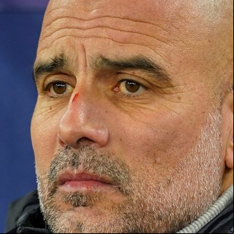 "Quiero lastimarme a mí mismo": Pep Guardiola pidió perdón tras la polémica frase sobre las heridas en su nariz y en su cabeza