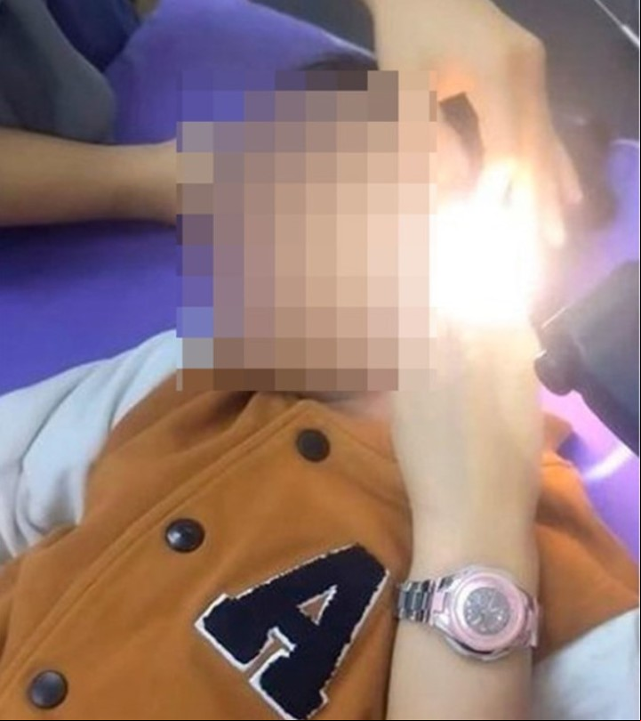 Su madre no vio nada anormal al alumbrarle la cavidad auditiva con una linterna (Twitter).