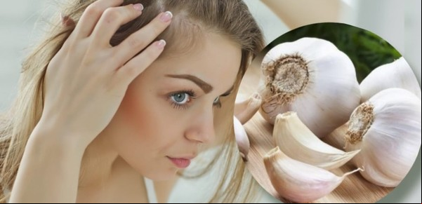 Cómo usar el ajo para fortalecer el cabello y evitar la caída del pelo