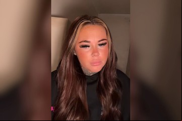 Quería obtener un bronceado más intenso en su piel y cometió un error: "Muy peligroso"