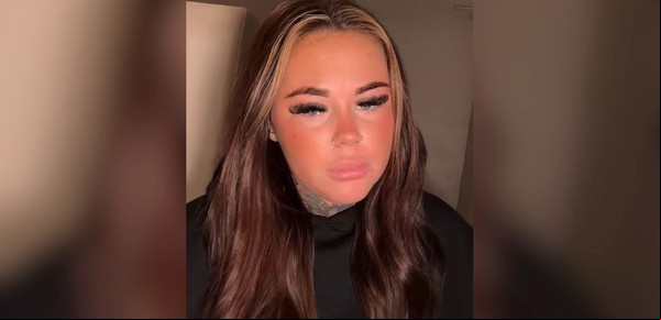 Quería obtener un bronceado más intenso en su piel y cometió un error: "Muy peligroso"