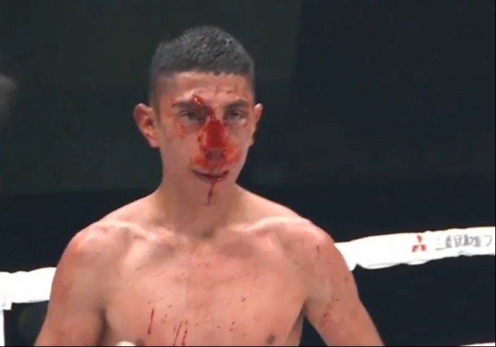 El mexicano Ángel Ayala, con el rostro ensangrentado durante su combate con Masamichi Yabuki.