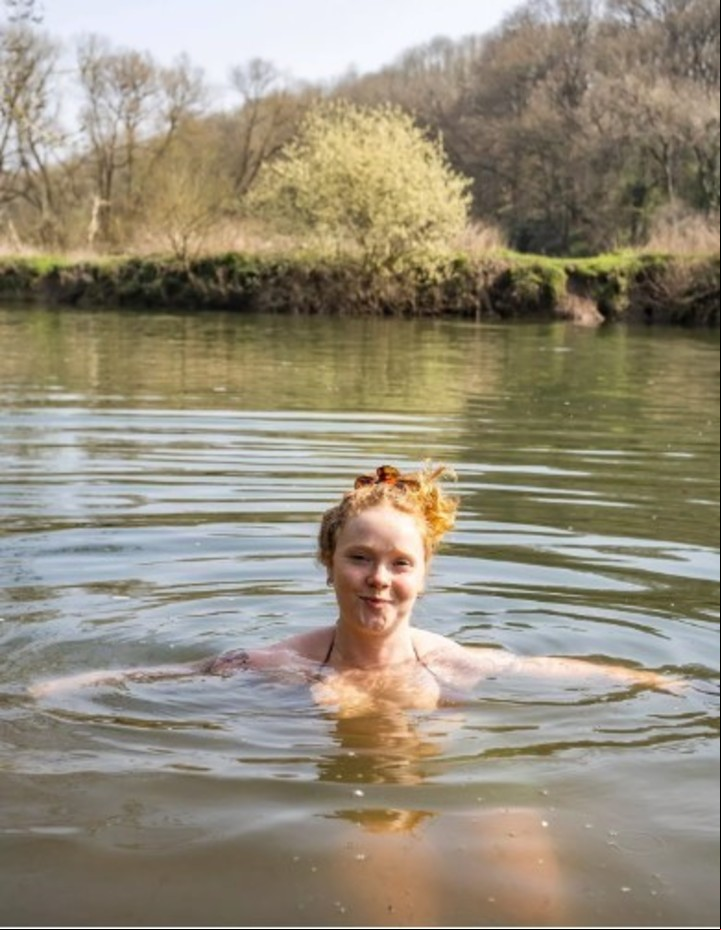Meg se rompió la pierna nadando en el río, pero su matrimonio con él sigue fuerte (SWNS).