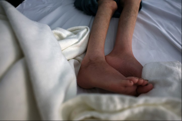 Desnutrición en una niña palestina de 12 años. Foto: Reuters