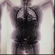 Iba a viajar 36 horas con 90 cápsulas de cocaína en sus intestinos: salió de Perú y cayó en Ezeiza